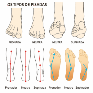 Tipos de Pisada e suas Consequências Posturais