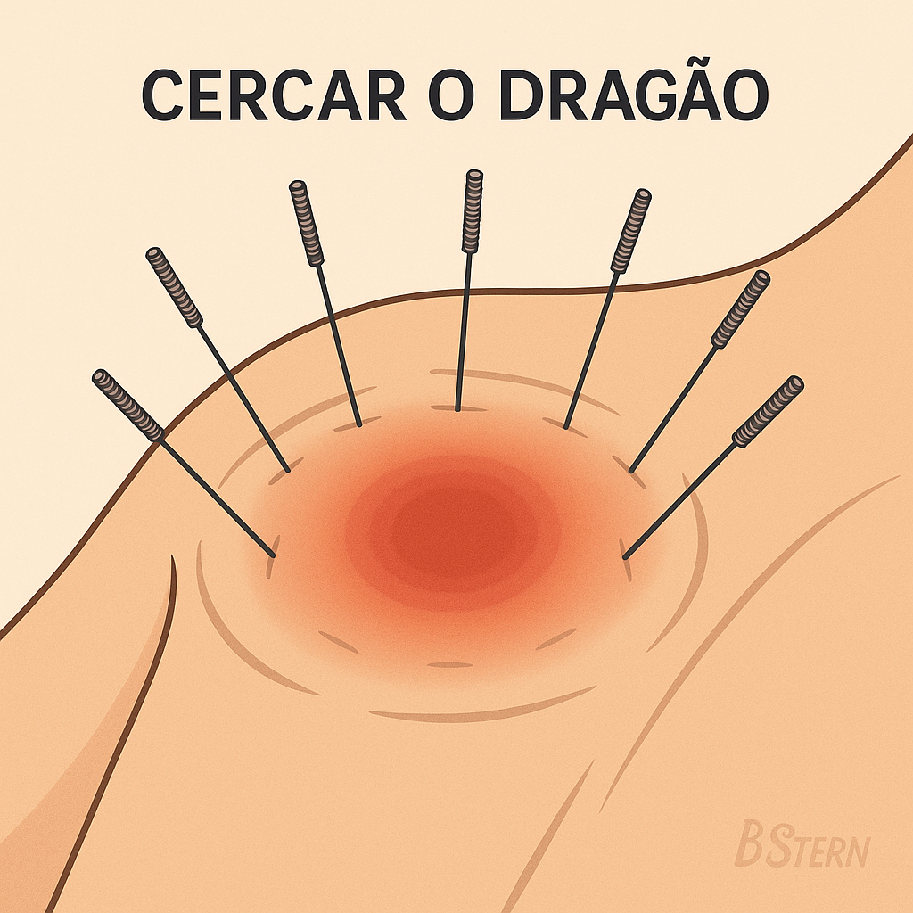 Técnica de acupuntura “Cercar o Dragão”: como funciona e quais os benefícios🐉